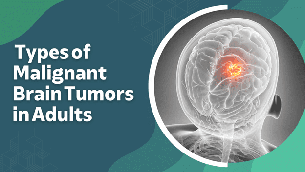 Types of Malignant Brain Tumors in Adults