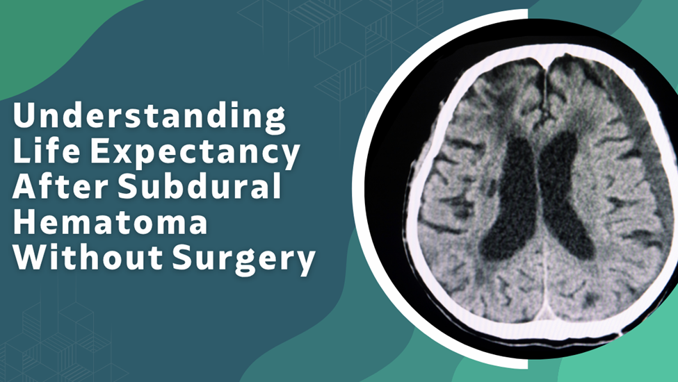 Understanding Life Expectancy After Subdural Hematoma Without Surgery