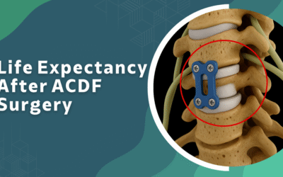 Life Expectancy After ACDF Surgery