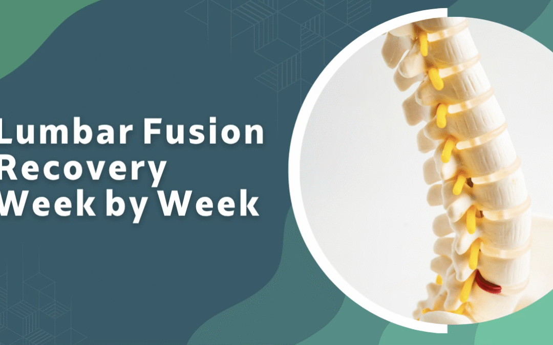 Lumbar Fusion Recovery Week by Week: A Complete Guide