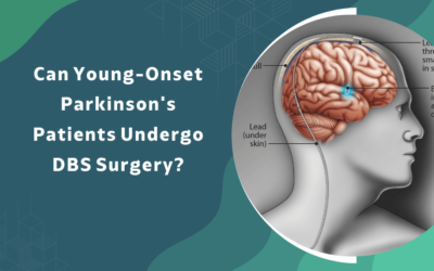 Can Young Onset Parkinson’s Patients Undergo DBS Surgery