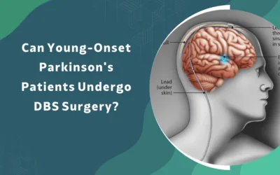 Can Young Onset Parkinson’s Patients Undergo DBS Surgery