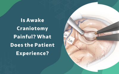 Is Awake Craniotomy Painful? What to Expect