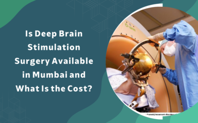 Deep Brain Stimulation Surgery Mumbai Cost