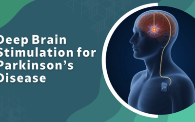 Deep Brain Stimulation for Parkinson’s Disease