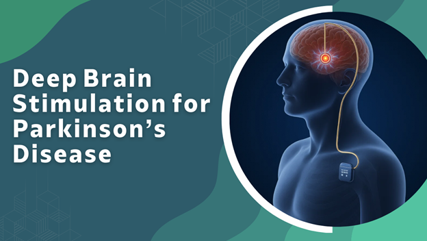 Deep Brain Stimulation for Parkinson’s Disease