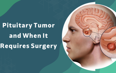 Pituitary Tumor and When It Requires Surgery