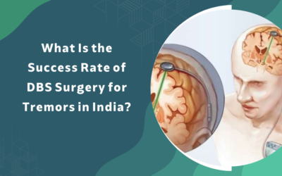 Success Rate of DBS Surgery for Tremors in India