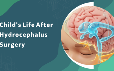 Child’s Life After Hydrocephalus Surgery