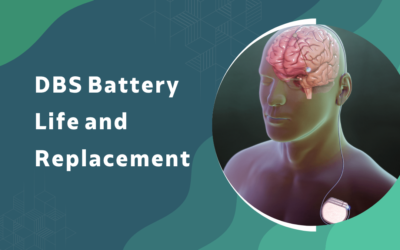 How Long Does a DBS Battery Last and When Does It Need Replacement?