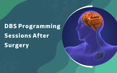 What Happens During DBS Programming Sessions After Surgery?