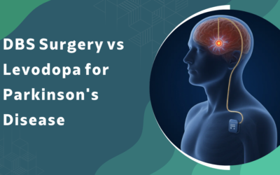 DBS Surgery vs Levodopa for Parkinson’s Disease