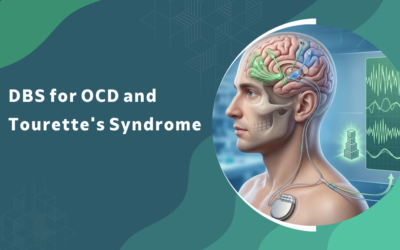 Can DBS Treat OCD or Tourette’s Syndrome?