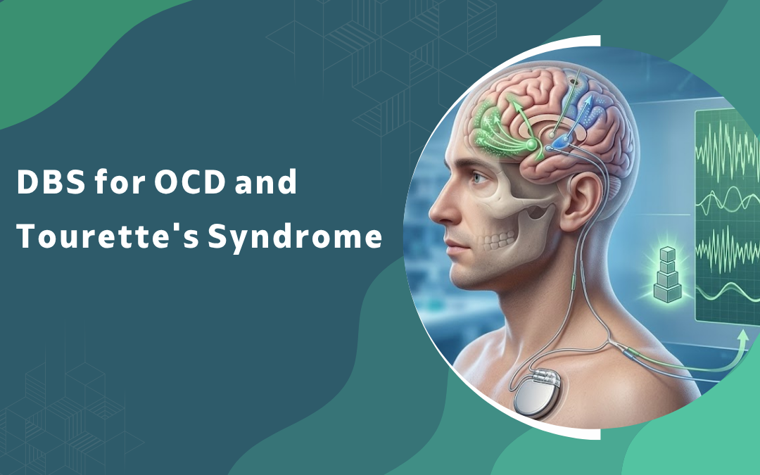 DBS for OCD and Tourettes Syndrome