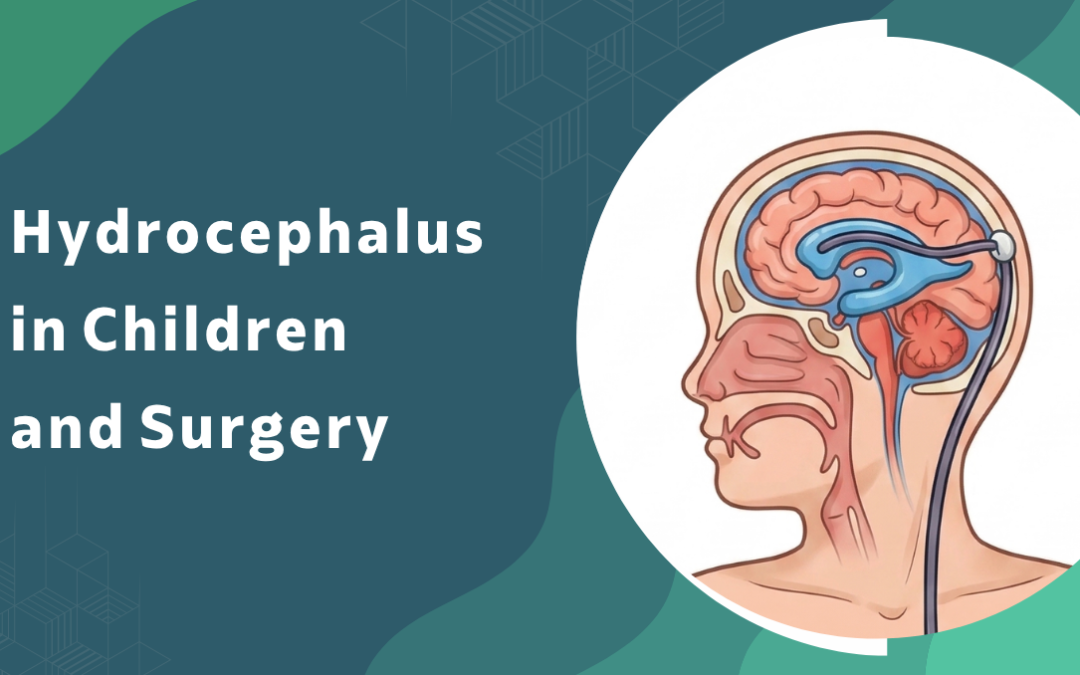 Hydrocephalus-in-Children-and-Surgery