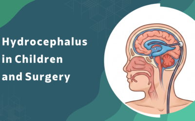 Hydrocephalus in Children and Surgery?