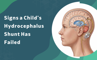 Signs a Child’s Hydrocephalus Shunt Has Failed?