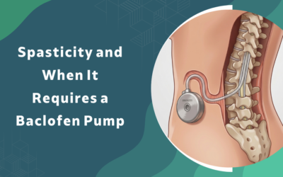 Spasticity and When It Requires a Baclofen Pump