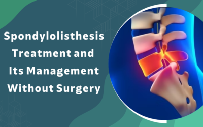 Spondylolisthesis Treatment and Its Management Without Surgery