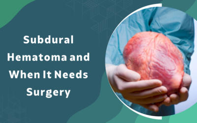 Subdural Hematoma and When It Needs Surgery