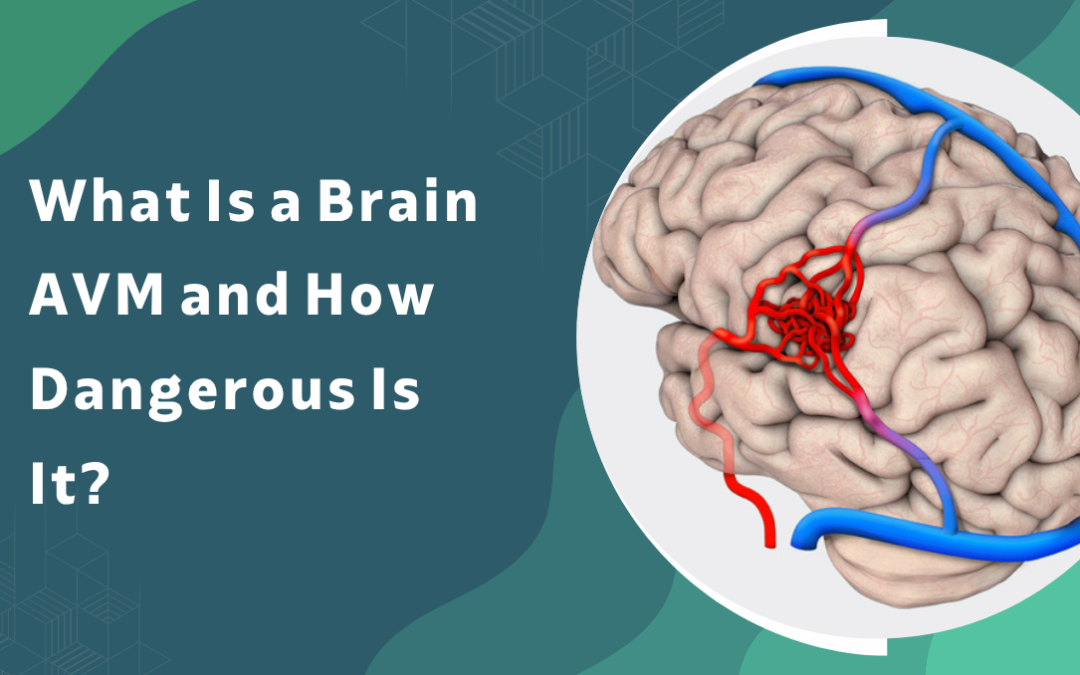 What Is a Brain AVM and How Dangerous Is It?