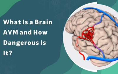 What Is a Brain AVM and How Dangerous Is It?