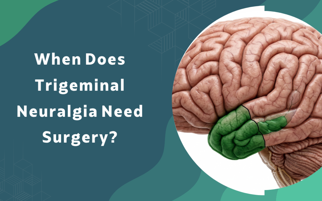 When-Does-Trigeminal-Neuralgia-Need-Surgery