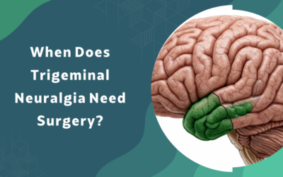 When Does Trigeminal Neuralgia Need Surgery?