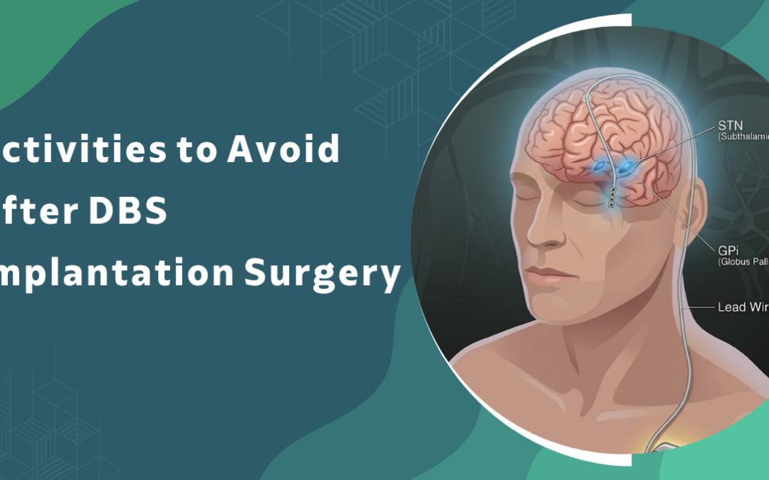 Activities to Avoid After DBS Implantation Surgery