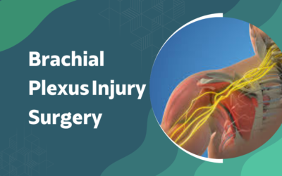 Can a Brachial Plexus Injury Be Repaired With Surgery?