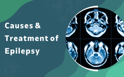Causes of Epilepsy: How Is It Diagnosed and Treated?