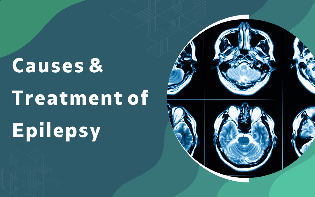 Causes Treatment of Epilepsy