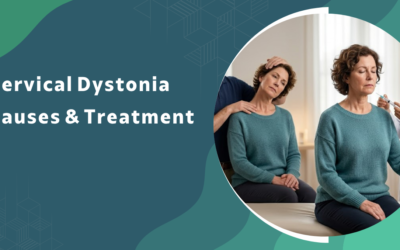 What is cervical dystonia (torticollis) and how is it treated?