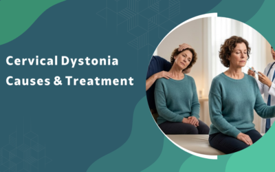 What is cervical dystonia (torticollis) and how is it treated?