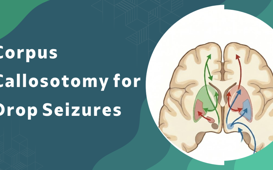 Corpus Callosotomy for Drop Seizures
