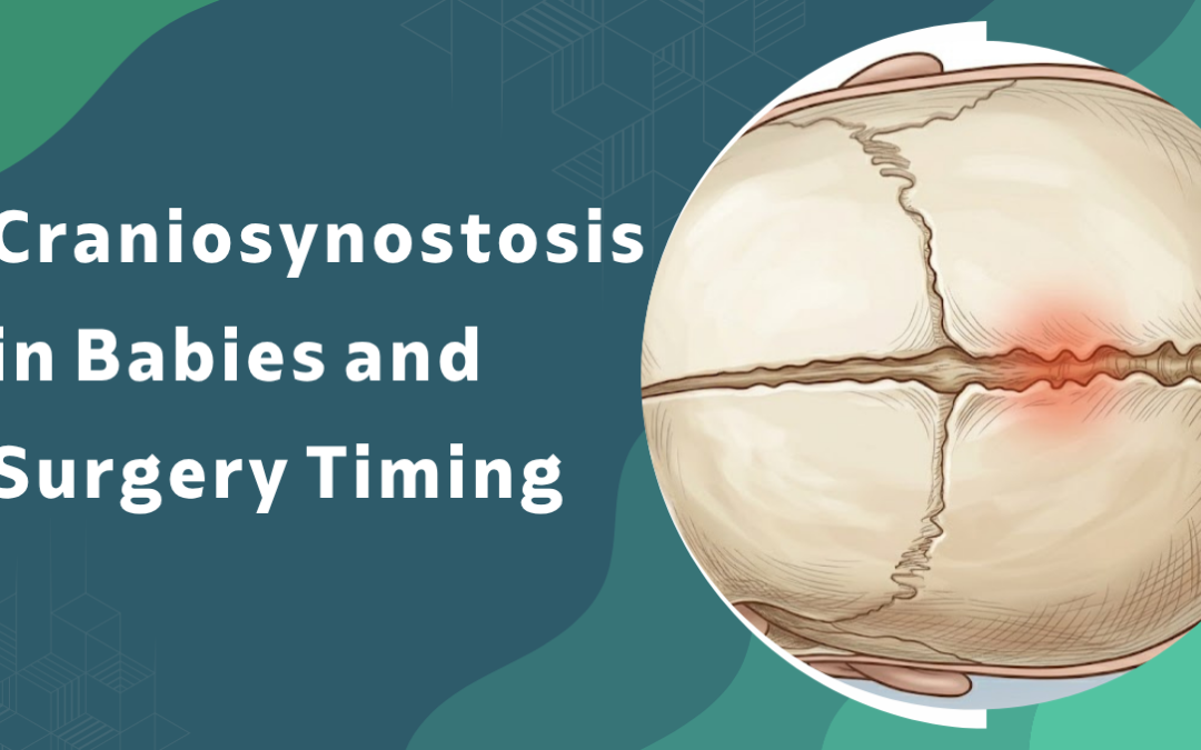 Craniosynostosis in Babies and Surgery Timing