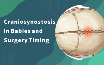 What is craniosynostosis in babies and when is surgery needed?