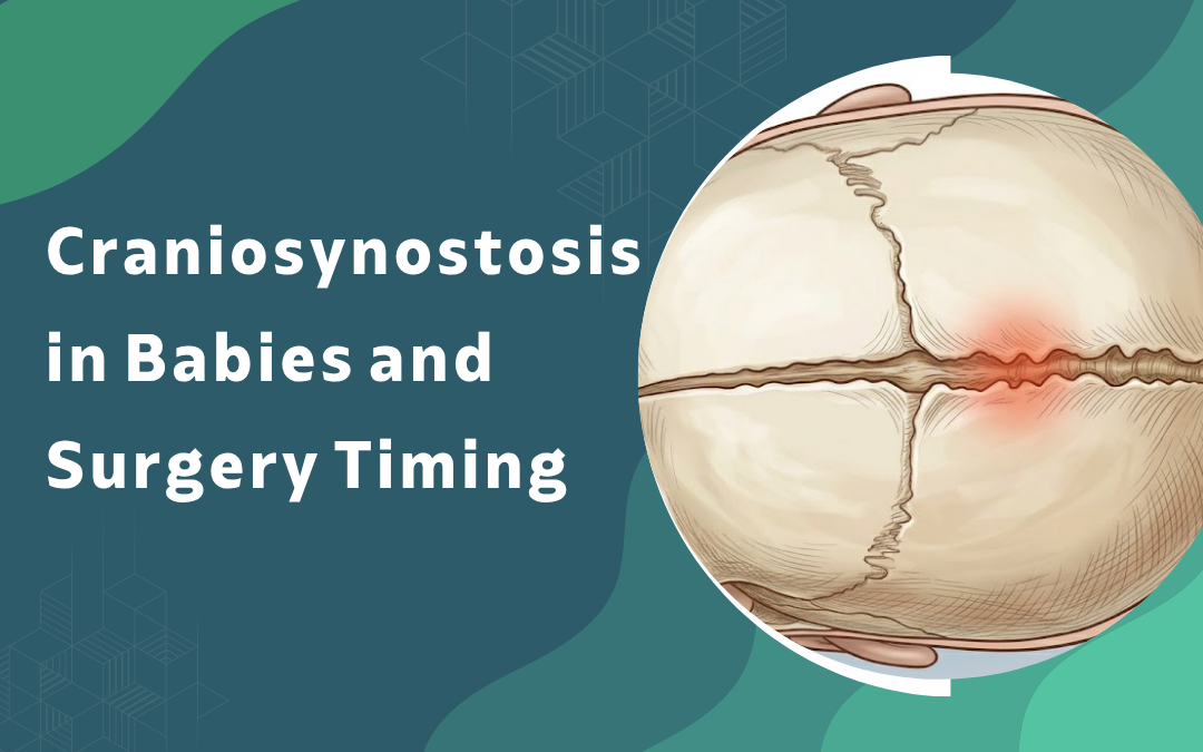 Craniosynostosis in Babies and Surgery Timing