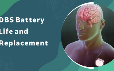 How Long Does a DBS Battery Last and When Does It Need Replacement?