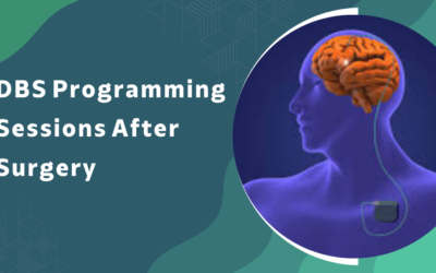 What Happens During DBS Programming Sessions After Surgery?