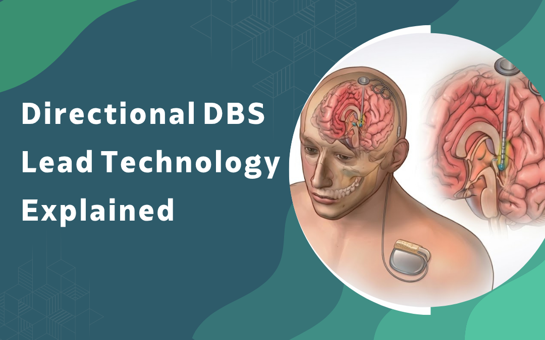 Directional DBS Lead Technology Explained