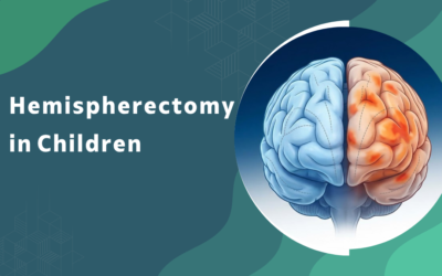 What is hemispherectomy and which children need this rare surgery?