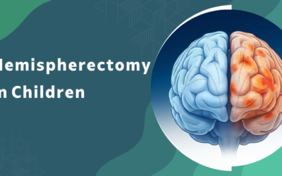 What is hemispherectomy and which children need this rare surgery?