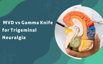 What is the difference between MVD and Gamma Knife for trigeminal neuralgia?