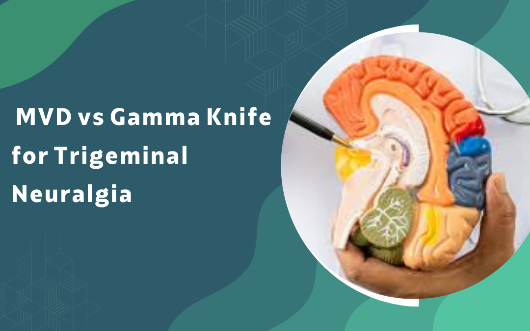 MVD vs Gamma Knife for Trigeminal Neuralgia