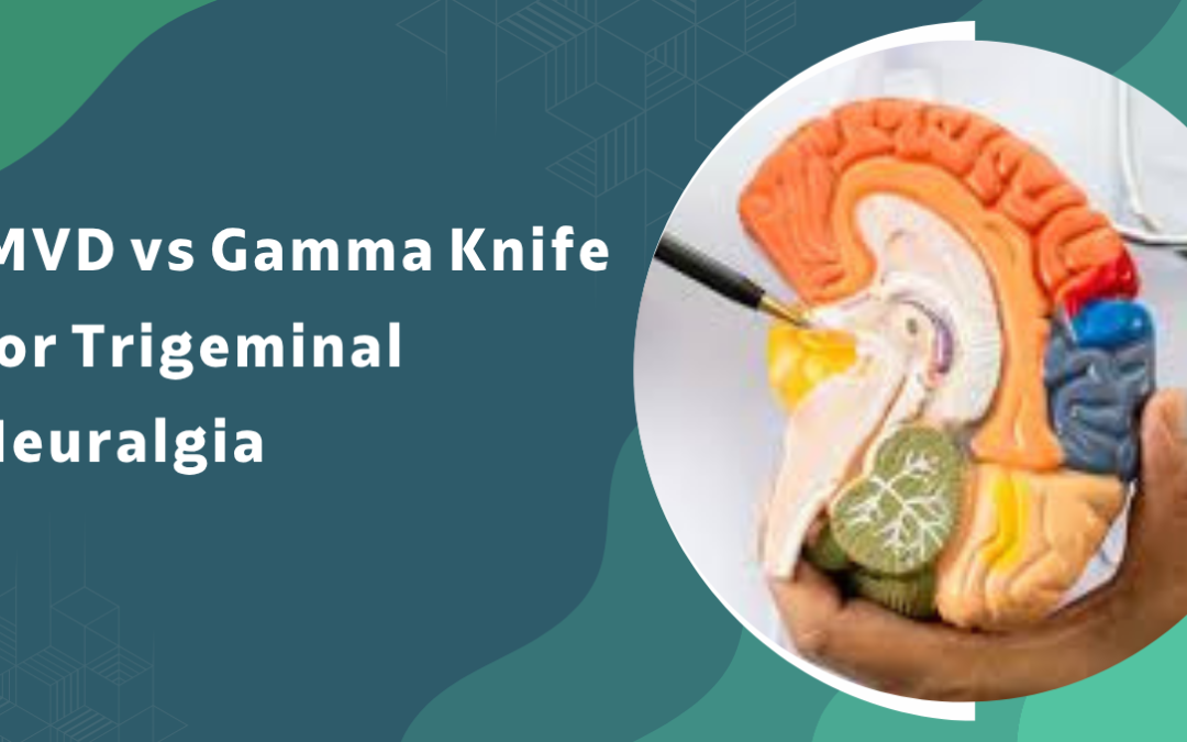 What is the difference between MVD and Gamma Knife for trigeminal neuralgia?