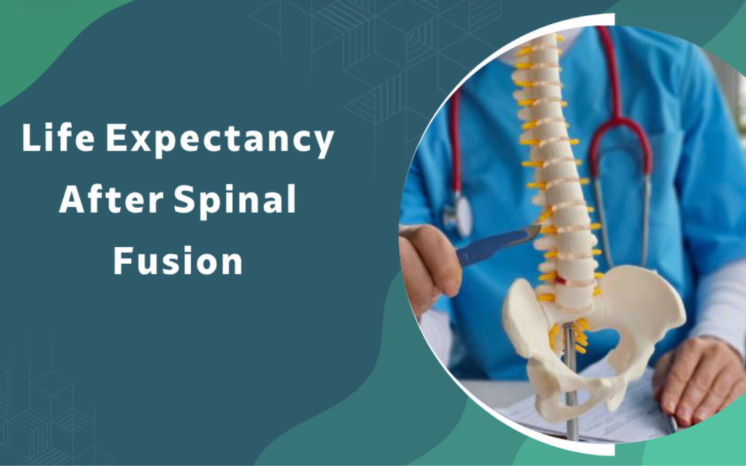 Banner showing a clinician with a spine model, conveying life expectancy after spinal fusion.