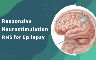 What is Responsive Neurostimulation (RNS) for Epilepsy and is it Available in India?