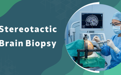 What is stereotactic brain biopsy and when is it required?