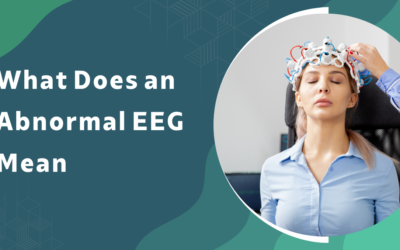 What does an abnormal EEG mean and does it always mean epilepsy?
